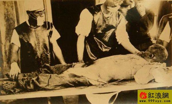 惨无人道:日本731部队活剖人体实照